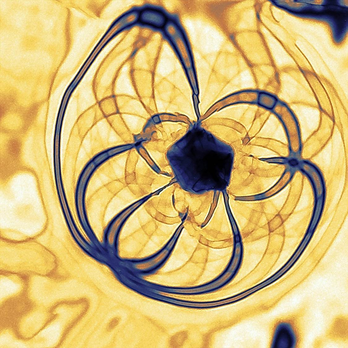 Imagen TEM de una nanopartícula de Oro